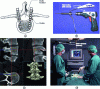 Figure 1 - GMCAO for screw placement in vertebrae: (a) screws in the pedicles; (b) 3D localization of the drilling tool thanks to rigid bodies attached to the tool and localized by a camera; (c) virtual model of the vertebra and planned optimal strategy; (d) intraoperative passive guidance (Photo credits: Laboratoire TIMC-IMAG &CHU de Grenoble)