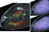 Figure 13 - Displacement field obtained from intraoperative ultrasound and preoperative MRA data (left) and corresponding global deformation simulated by the biomechanical brain model (right) (Photo credits: Laboratoire TIMC-IMAG &CHU de Grenoble)