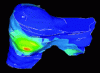 Figure 3 - Internal stress levels following simulated pressure on the right lobe of the liver (Photo credits: Laboratoire TIMC-IMAG)