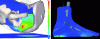 Figure 9 - Internal stresses simulated by a finite element model of the buttocks (left) and foot (right) subjected to external pressures (Photo credits: Laboratoire TIMC-IMAG)
