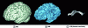 Figure 8 - Multisegmentation obtained fromIr a T1-weighted MRI image(© F. Rousseau, ICube, 2013).