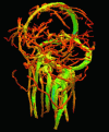 Figure 9 - Segmentation of cerebral vascular structures (millimeter scale) from a phase contrast ARM image (© N. Passat, LSIIT, 2012)