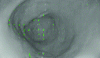 Figure 7 - Result of homologous point search using Lucas and Kanade's sparse optical flow method (gastroscopic image).