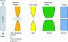 Figure 8 - The different macroscopic forms of rupture