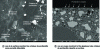 Figure 6 - SEM micrographs of portlandite crystals covering a concrete surface, previously molded in a form covered with an aqueous solution containing a non-ionic surfactant.