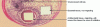 Figure 1 - Photograph of three different migrant and non-migrant antibacterial treatments (Scale ––: 2 cm)