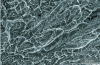 Figure 21 - Tensile ductile fracture facies on a Zr57Cu20Al10 Ni8Ti3 alloy: cup-shaped vein structure. 