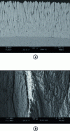 Figure 7 - (a) Columnar structure of thermal barriers deposited by EB-PVD, (b) detail of the structure [14].