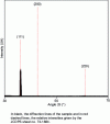 Figure 26 - Effect of wüstite grain orientation on diffraction peak intensity inversion (after [20])