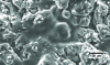 Figure 9 - SE-mode SEM observation of the surface topography of an alumina plasma deposit