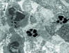 Figure 14 - Transmission electron microscopy of degrading magnetite nanoparticles (<) in the lymph node cells into which they have migrated (© Doc. Urodelia)