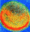 Figure 1 - Influenza virus – about 100 nm in size