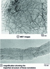 Figure 3 - Multiwall nanotubes produced by catalytic decomposition