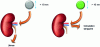 Figure 1 - Importance of nanoparticle size for renal elimination