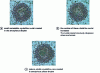 Figure 12 - Evolution of crystalline structures within an amorphous phase 