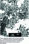 Figure 3 - Nanobeads 3.5 nm in diameter and 15 nm long