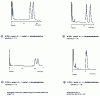 Figure 4 - Resolution of (1 - methyl - 3 - phenyl) propylamine and ethylphenethylamine after derivatization with N-TFA L-leucine chloride or N-TFA L-proline chloride