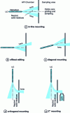 Figure 6 - Possible orientations of the ionization probe nebulizer in an API chamber, allowing more selective introduction of ions into the analyzer, and rejection of neutral molecules and non-vaporized residues.