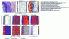 Figure 12 - Histological section and PIXE/RBS analysis of minerals in different layers of normal human skin