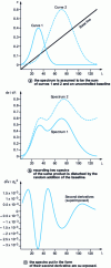 Figure 11 - Effect of second derivative on digitized spectra (adapted from [12])