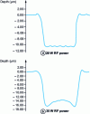 Figure 21 - Shape of the crater created in a copper sample according to operating conditions ((GDMS CEA). Profiles measured with a perthometer (Perthoconcept, Mahr))