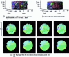 Figure 14 - 3D observation of the effect of annealing on the grain morphology of an Al-0.1%Mn alloy [12].