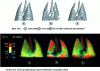 Figure 22 - 3D rendering of rabbit lung images obtained by subtraction around the xenon K threshold [37].