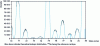 Figure 8 - Example of a spectrum illustrating Se isotopy before destruction of polyatomic interference