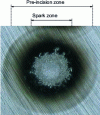 Figure 5 - Pre-incision sequence