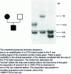 Figure 11 - Characterization of a nucleotide triplet expansion by Southern blot in a family with Steinert disease