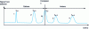 Figure 5 - Electrophoregram of the analysis of two cations (1 and 2), neutral molecules (N) and two anions (3 and 4) in the case of cathodic electroosmotic flow.