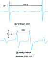 Figure 1 - EPR spectra