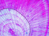 Figure 6 - Decrease in lumen surface of initial wood tracheids due to root venting