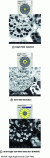 Figure 28 - Cat bone marrow sample observed in STEM at 10 kV, according to the different sectors of an example of a transmitted electron detector.