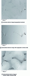 Figure 6 - Solidification dendritic structure of a stainless steel with tungsten carbide precipitation