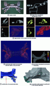 Figure 16 - Dimensional study of an aluminum engine cradle using X-ray tomography (Tomo Adour 140 kV industrial tomograph), taking into account porosities and microporosity agglomerates (doc. PSA Peugeot Citroën).