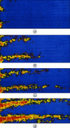 Figure 18 - Visualization of gas displacement in a water-saturated core (doc. Institut français du pétrole IFP, COFREND collaboration)