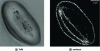 Figure 19 - Snowdrop pollen using ToRI diffractive tomography (real part) and confocal tomography (autofluorescence) [20].