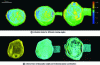 Figure 22 - Birch (Betula) pollen tomography combining object rotation and illumination