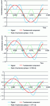 Figure 3 - Influence of a 3rd-order harmonic on the peak value for three different phase shift values