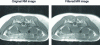 Figure 41 - Wiener filter denoising of a medical image