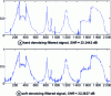 Figure 20 - Hard thresholding and soft thresholding denoising results