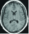 Figure 4 - MR image of brain anatomy (axial section) obtained by inverse two-dimensional Fourier transformation of the image in figure 3.