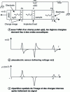 Figure 11 - Principle of the PEA method