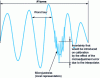 Figure 21 - Typical single-headed encoder error over several turns