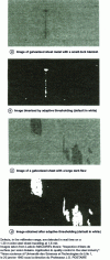Figure 4 - Examples of image processing for surface quality control