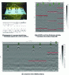 Figure 10 - Example of auscultation with the UPE ® ACSYS system