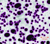 Figure 11 - Example of image processing of a two-phase flow (gas-liquid) with high object superposition