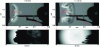 Figure 26 - Comparison of global and zoomed views (red rectangle) at t = 0.8 ms and t = 0.15 ms