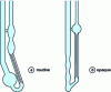 Figure 15 - Cannon-Fenske viscometers